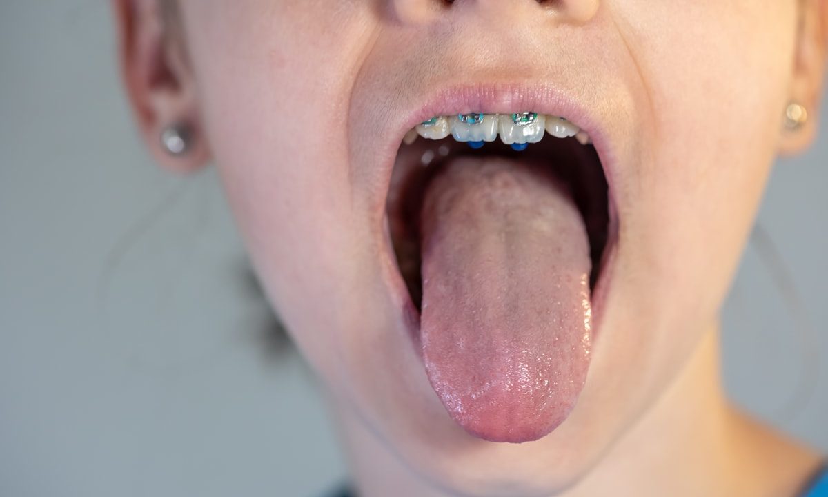 A legnehezebb nyelvtörők és a fejlesztő beszédjátékok