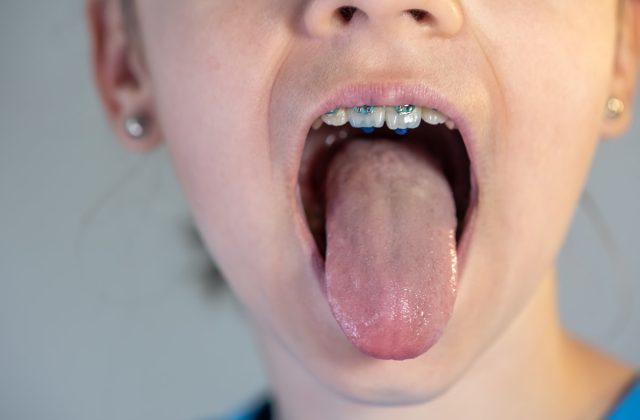 A legnehezebb nyelvtörők és a fejlesztő beszédjátékok